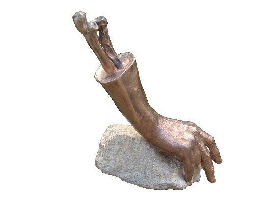 A Bodycasting of a hand and arm, cast into bronze